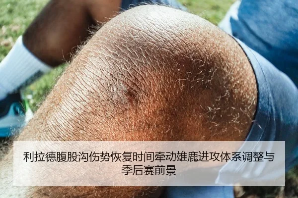 利拉德腹股沟伤势恢复时间牵动雄鹿进攻体系调整与季后赛前景